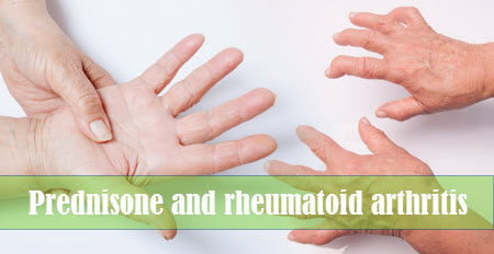 Treatment of rheumatoid arthritis with Prednisone