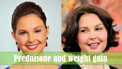 Prednisone and weight gain